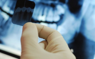 Дентальный рентген, который должен быть в каждой стоматологической поликлинике