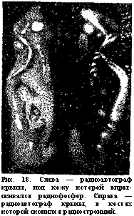 подпись: 
рис. 18. слева — радиоавтограф крысы, под кожу которой впры-скивался радиофосфор. справа — радиоавтограф крысы, в костях которой скопился радиостронций.
