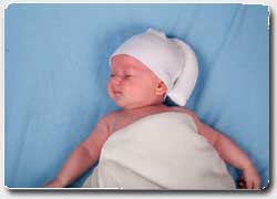 Шапочка-бини для малышей против синдрома плоской головы (плагиоцефалии)