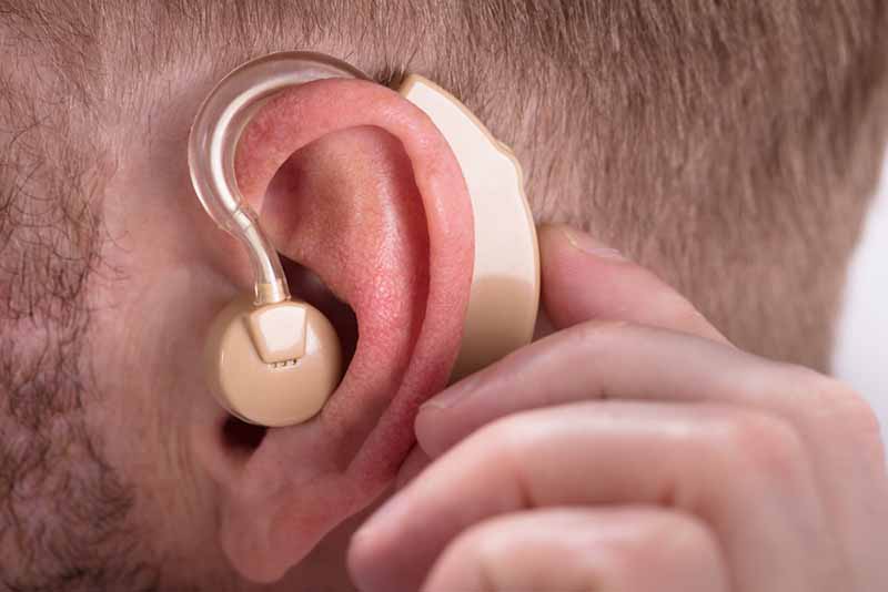 диагностика и подбор слухового аппарата